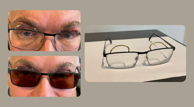 Specialbrille der hjælper med at holde øjnelåget åbent